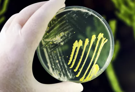般的に利用されている園芸用微生物の種類と効果